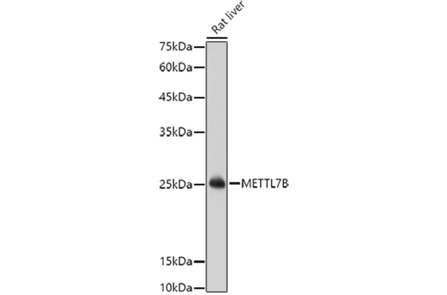 Western Blot - Anti-METTL7B Antibody (A15591) - Antibodies.com