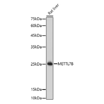 Western Blot - Anti-METTL7B Antibody (A15591) - Antibodies.com