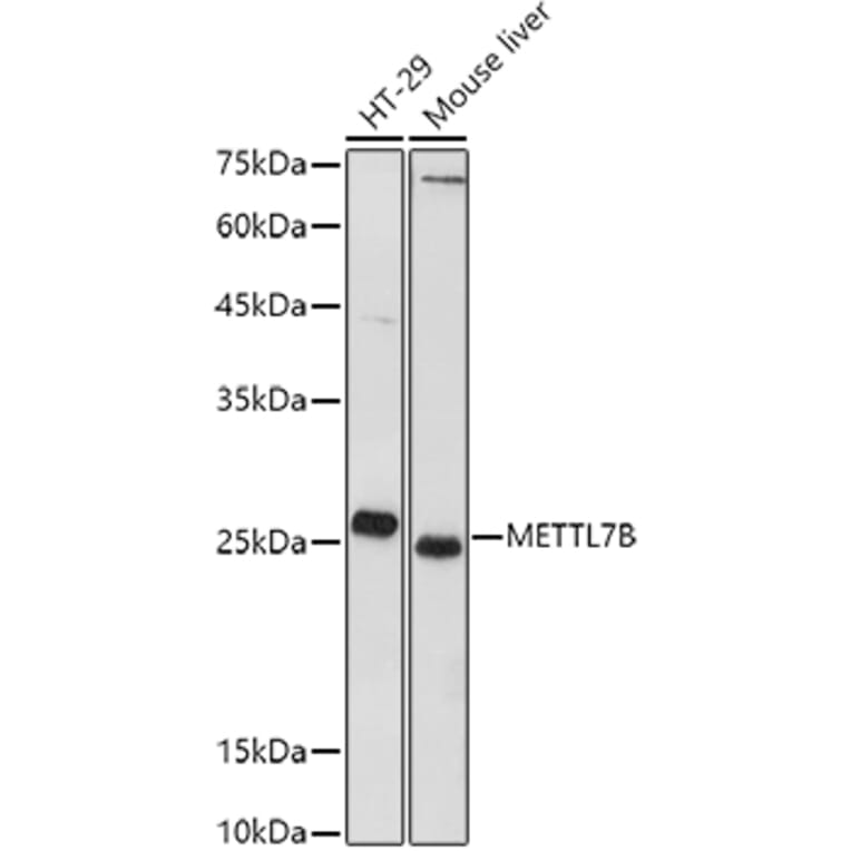 Western Blot - Anti-METTL7B Antibody (A15591) - Antibodies.com