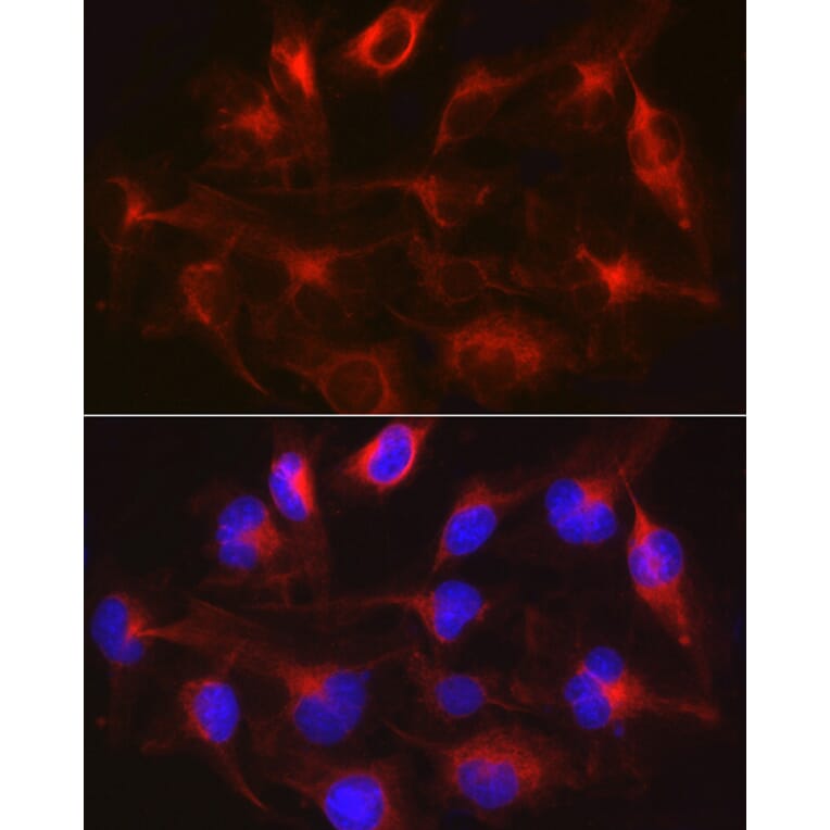 Immunofluorescence - Anti-METTL7B Antibody (A15591) - Antibodies.com
