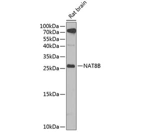 Western Blot - Anti-NAT8B Antibody (A15592) - Antibodies.com