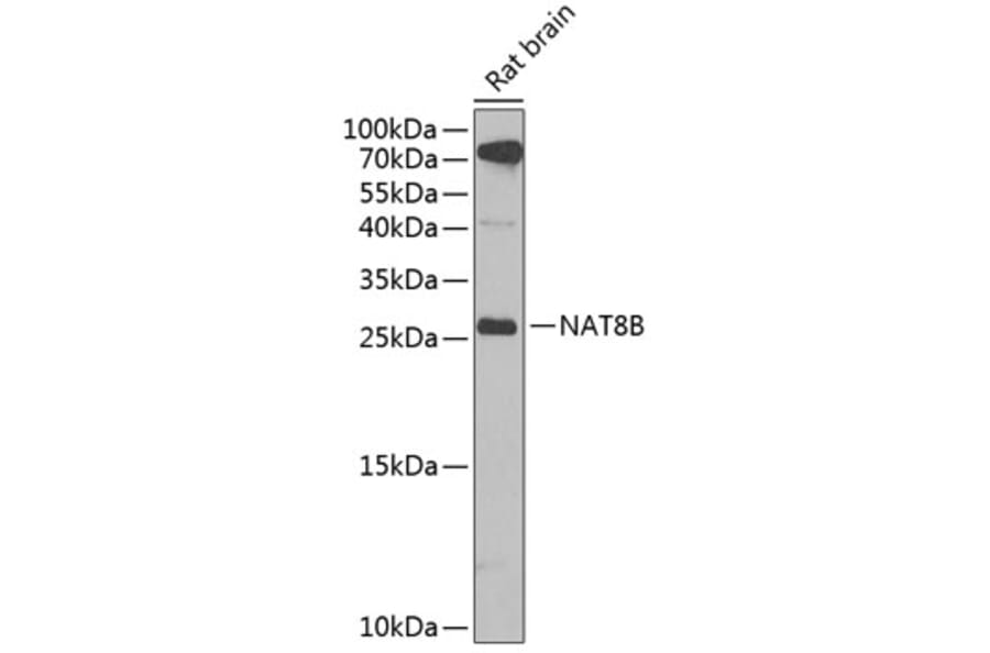 Western Blot - Anti-NAT8B Antibody (A15592) - Antibodies.com