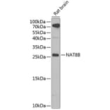 Western Blot - Anti-NAT8B Antibody (A15592) - Antibodies.com