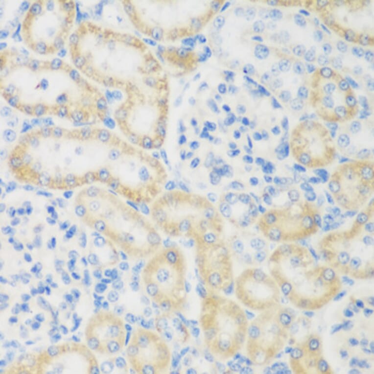 Immunohistochemistry - Anti-NAT8B Antibody (A15592) - Antibodies.com