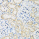 Immunohistochemistry - Anti-NAT8B Antibody (A15592) - Antibodies.com