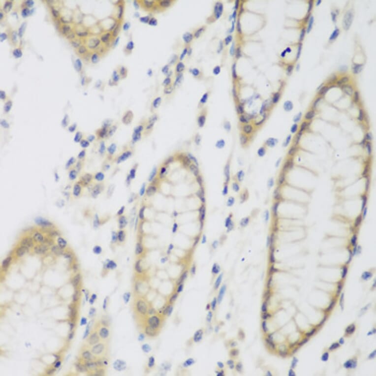 Immunohistochemistry - Anti-NAT8B Antibody (A15592) - Antibodies.com
