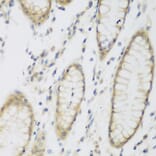 Immunohistochemistry - Anti-NAT8B Antibody (A15592) - Antibodies.com