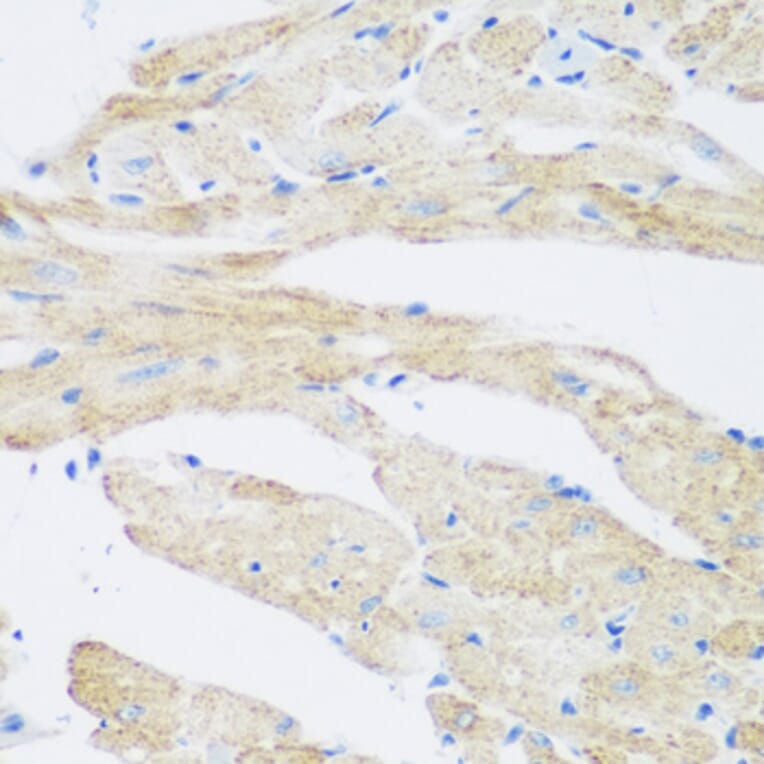 Immunohistochemistry - Anti-NAT8B Antibody (A15592) - Antibodies.com