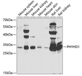 Western Blot - Anti-PHYHD1 Antibody (A15593) - Antibodies.com