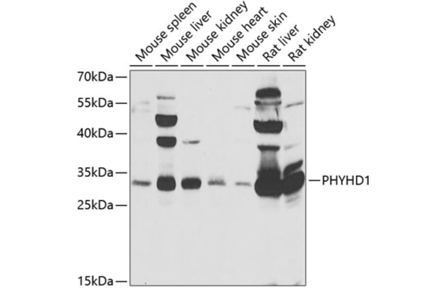 Western Blot - Anti-PHYHD1 Antibody (A15593) - Antibodies.com
