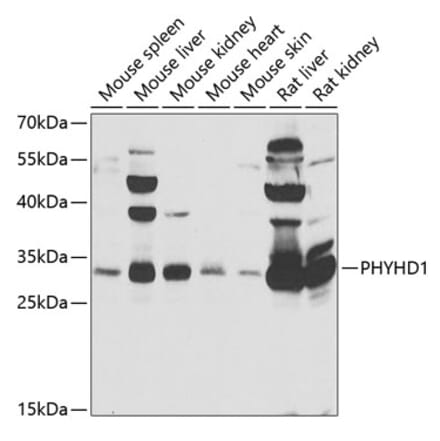 Western Blot - Anti-PHYHD1 Antibody (A15593) - Antibodies.com