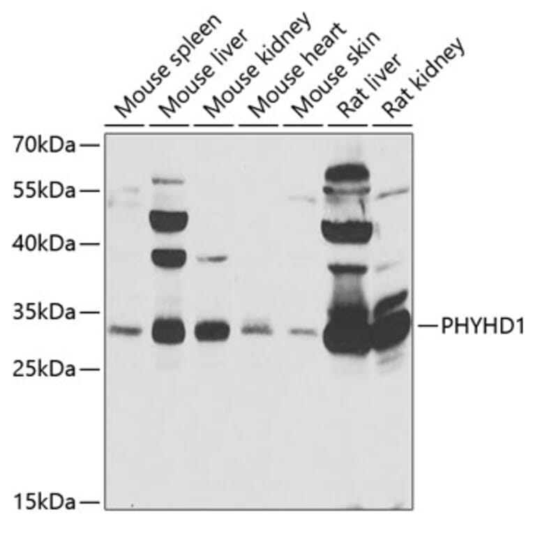 Western Blot - Anti-PHYHD1 Antibody (A15593) - Antibodies.com