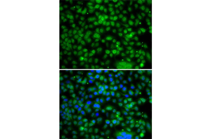Immunofluorescence - Anti-PHYHD1 Antibody (A15593) - Antibodies.com