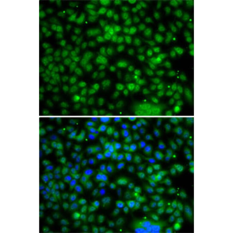 Immunofluorescence - Anti-PHYHD1 Antibody (A15593) - Antibodies.com