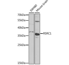 Western Blot - Anti-RSRC1 Antibody (A15594) - Antibodies.com