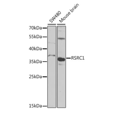 Western Blot - Anti-RSRC1 Antibody (A15594) - Antibodies.com