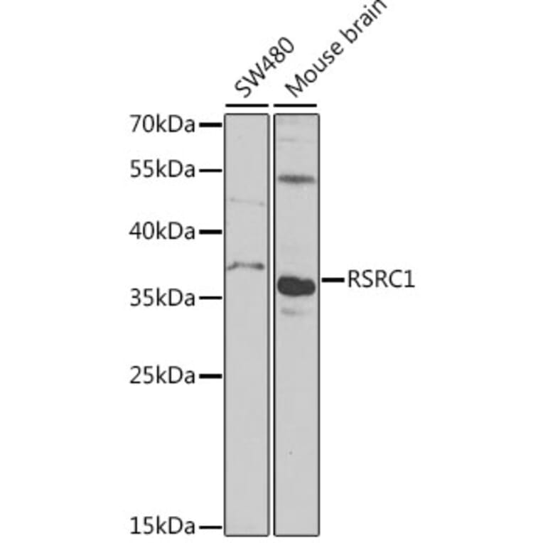 Western Blot - Anti-RSRC1 Antibody (A15594) - Antibodies.com