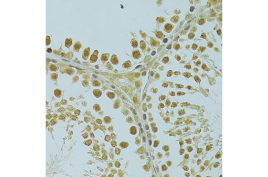Immunohistochemistry - Anti-RSRC1 Antibody (A15594) - Antibodies.com