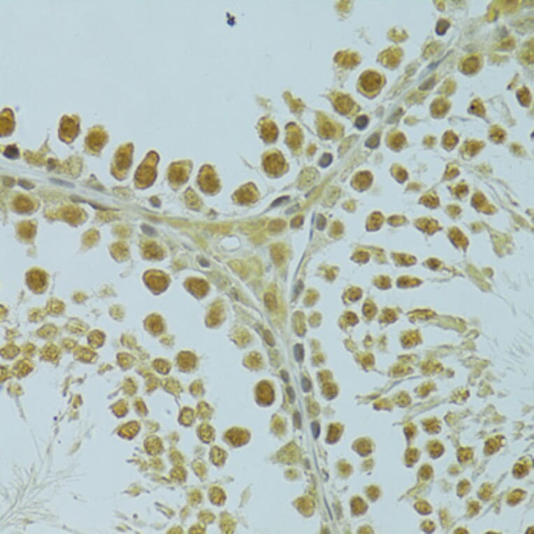 Immunohistochemistry - Anti-RSRC1 Antibody (A15594) - Antibodies.com