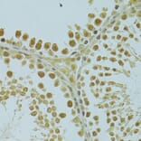 Immunohistochemistry - Anti-RSRC1 Antibody (A15594) - Antibodies.com