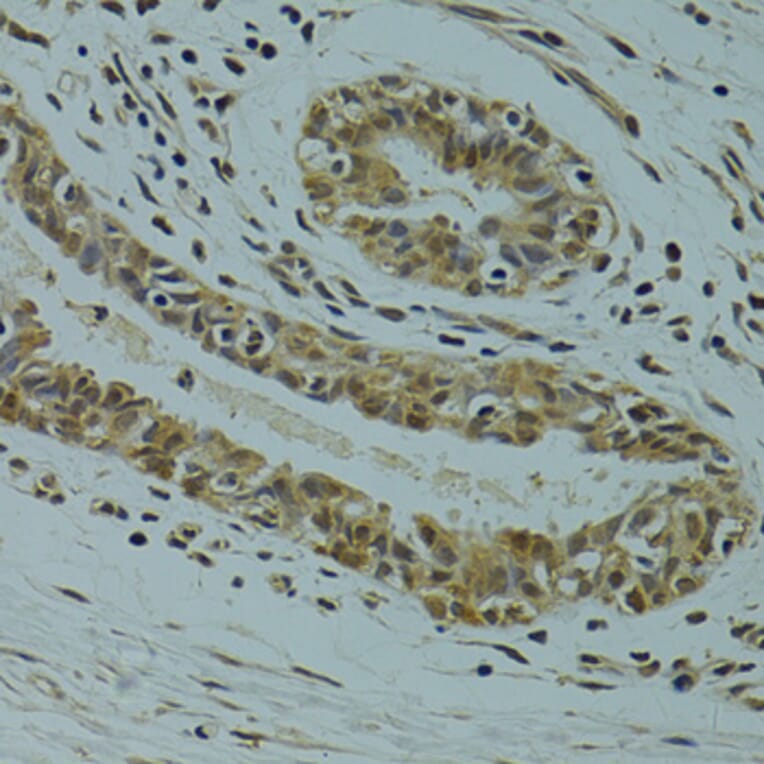 Immunohistochemistry - Anti-RSRC1 Antibody (A15594) - Antibodies.com