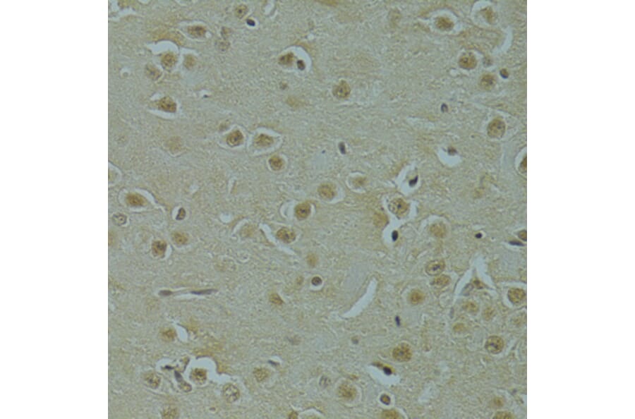 Immunohistochemistry - Anti-RSRC1 Antibody (A15594) - Antibodies.com