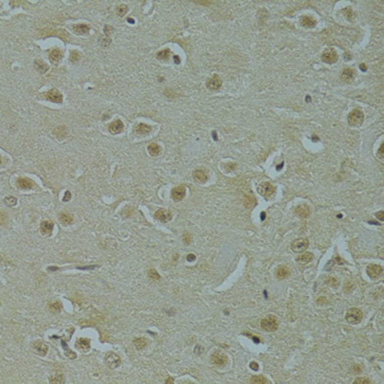 Immunohistochemistry - Anti-RSRC1 Antibody (A15594) - Antibodies.com