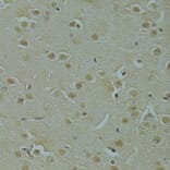 Immunohistochemistry - Anti-RSRC1 Antibody (A15594) - Antibodies.com