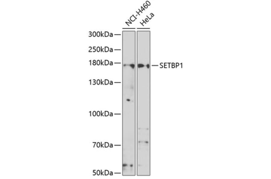 Western Blot - Anti-SETBP1 Antibody (A15595) - Antibodies.com