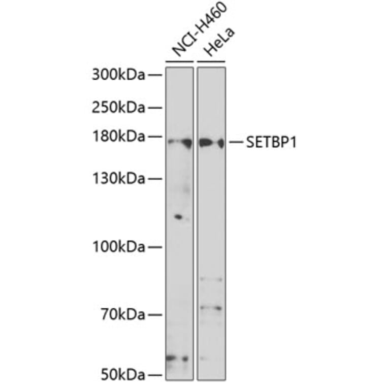Western Blot - Anti-SETBP1 Antibody (A15595) - Antibodies.com