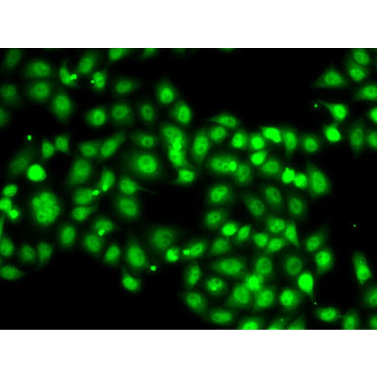 Immunofluorescence - Anti-SETBP1 Antibody (A15595) - Antibodies.com