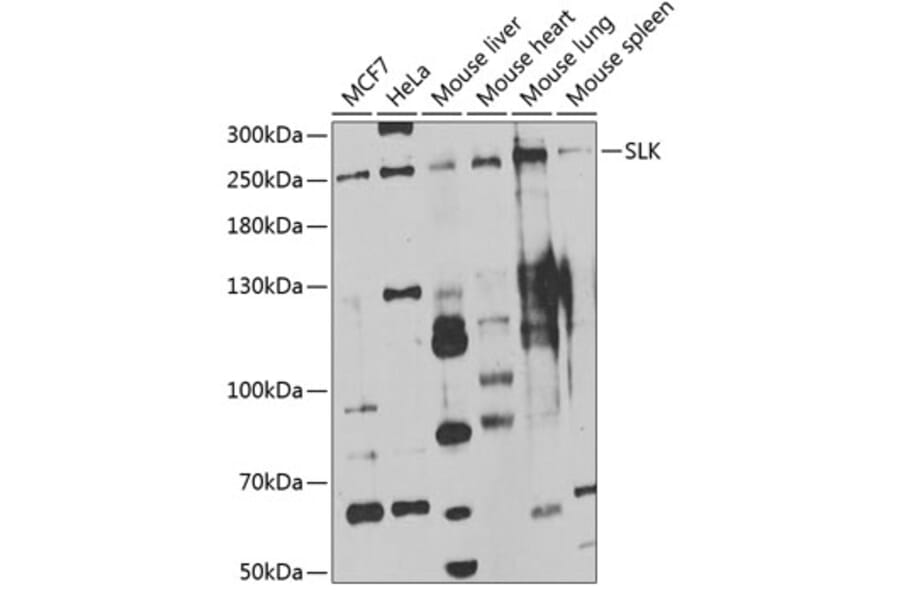 Western Blot - Anti-SLK Antibody (A7213) - Antibodies.com