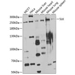 Western Blot - Anti-SLK Antibody (A7213) - Antibodies.com