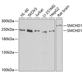 Western Blot - Anti-SMCHD1 Antibody (A15597) - Antibodies.com