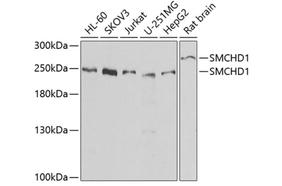 Western Blot - Anti-SMCHD1 Antibody (A15597) - Antibodies.com