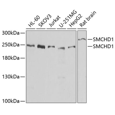 Western Blot - Anti-SMCHD1 Antibody (A15597) - Antibodies.com