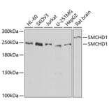 Western Blot - Anti-SMCHD1 Antibody (A15597) - Antibodies.com