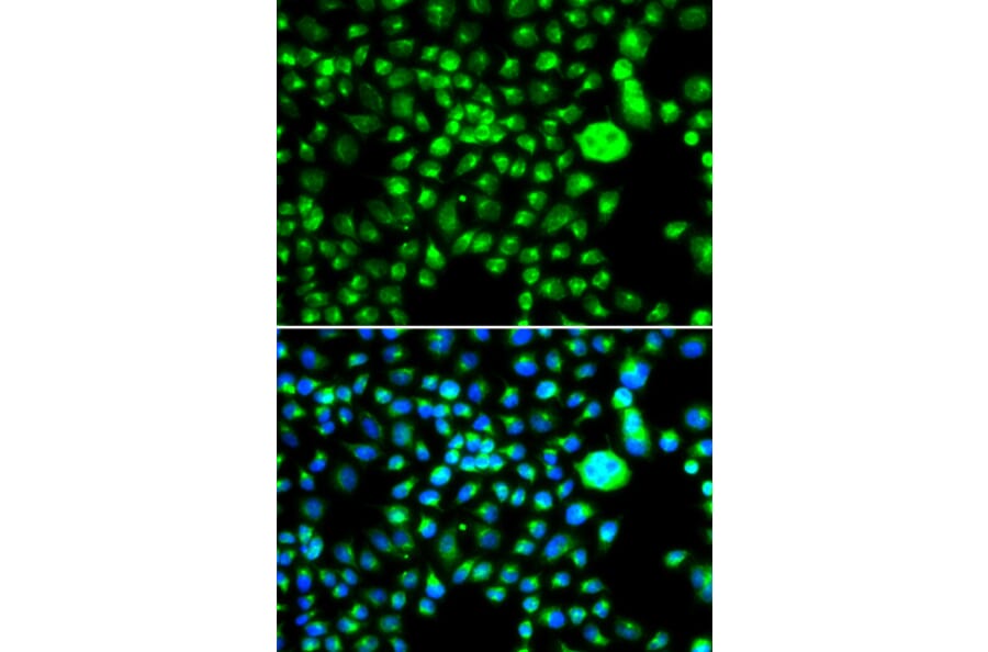 Immunofluorescence - Anti-SMCHD1 Antibody (A15597) - Antibodies.com