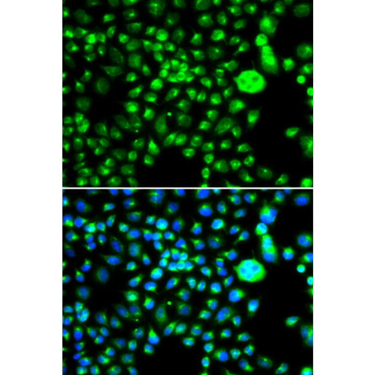 Immunofluorescence - Anti-SMCHD1 Antibody (A15597) - Antibodies.com
