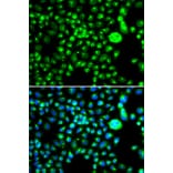 Immunofluorescence - Anti-SMCHD1 Antibody (A15597) - Antibodies.com