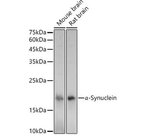 Western Blot - Anti-Alpha-synuclein Antibody (A15598) - Antibodies.com