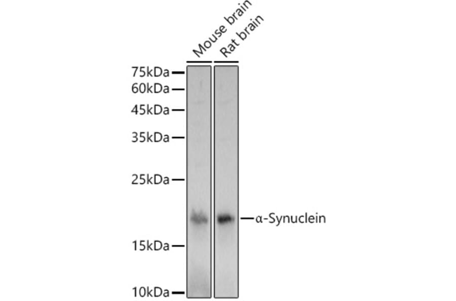 Western Blot - Anti-Alpha-synuclein Antibody (A15598) - Antibodies.com