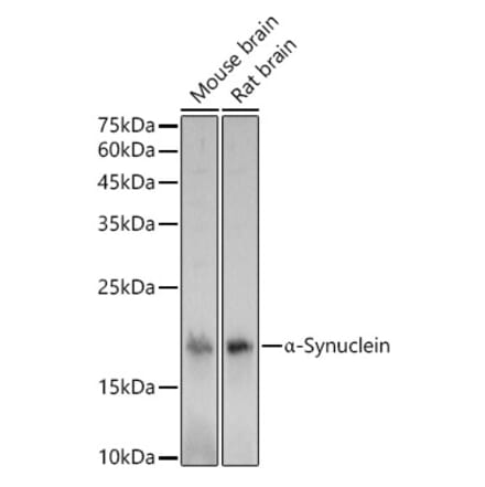 Western Blot - Anti-Alpha-synuclein Antibody (A15598) - Antibodies.com