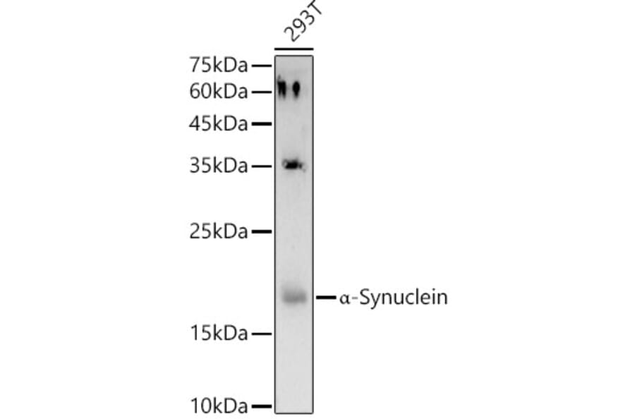 Western Blot - Anti-Alpha-synuclein Antibody (A15598) - Antibodies.com