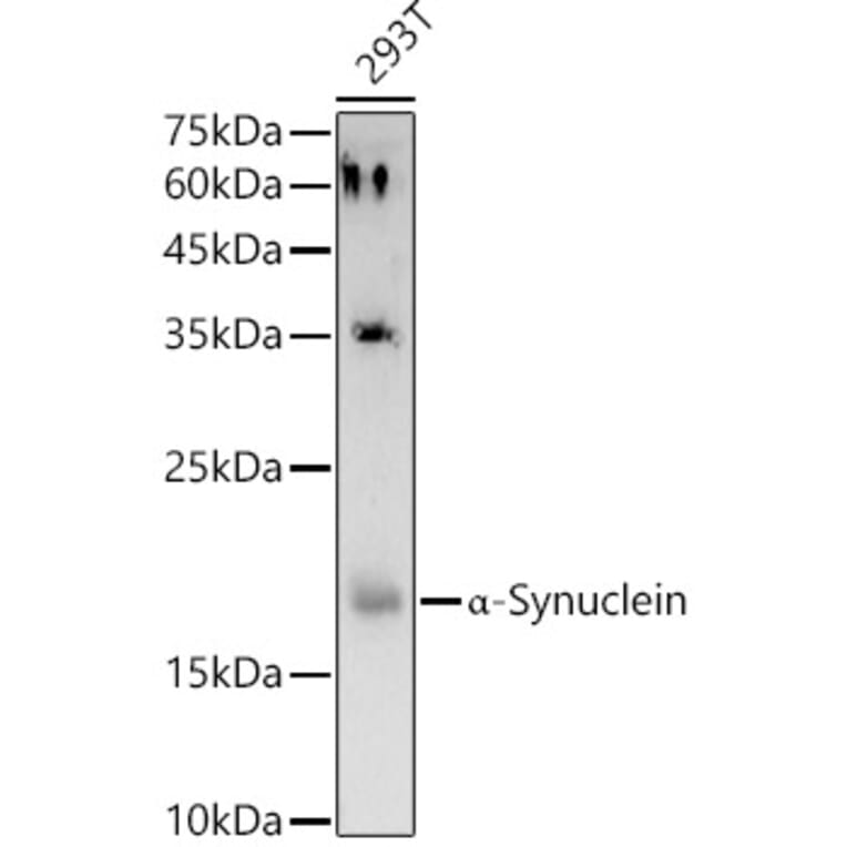 Western Blot - Anti-Alpha-synuclein Antibody (A15598) - Antibodies.com