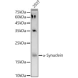 Western Blot - Anti-Alpha-synuclein Antibody (A15598) - Antibodies.com