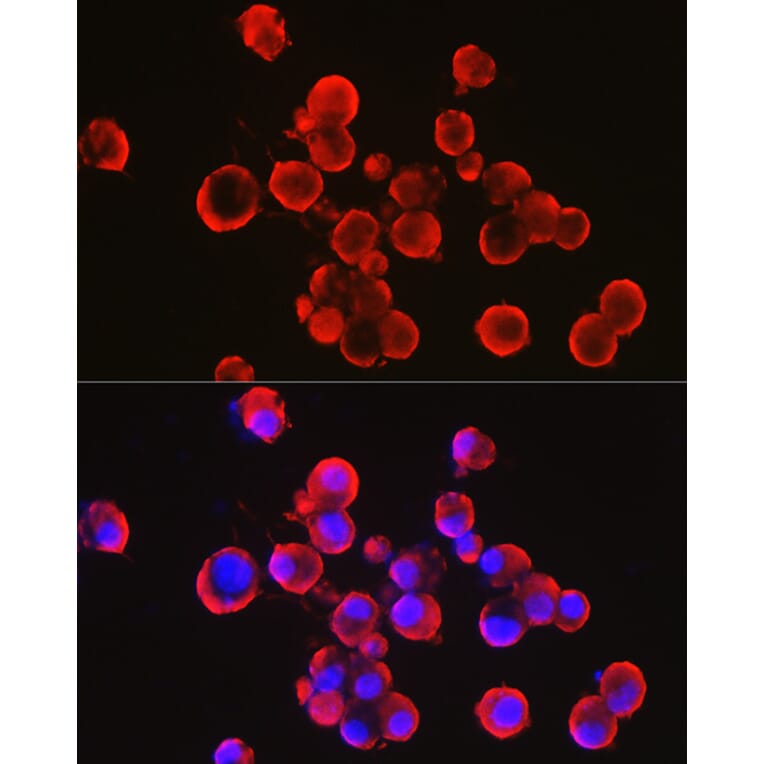 Immunofluorescence - Anti-Alpha-synuclein Antibody (A15598) - Antibodies.com