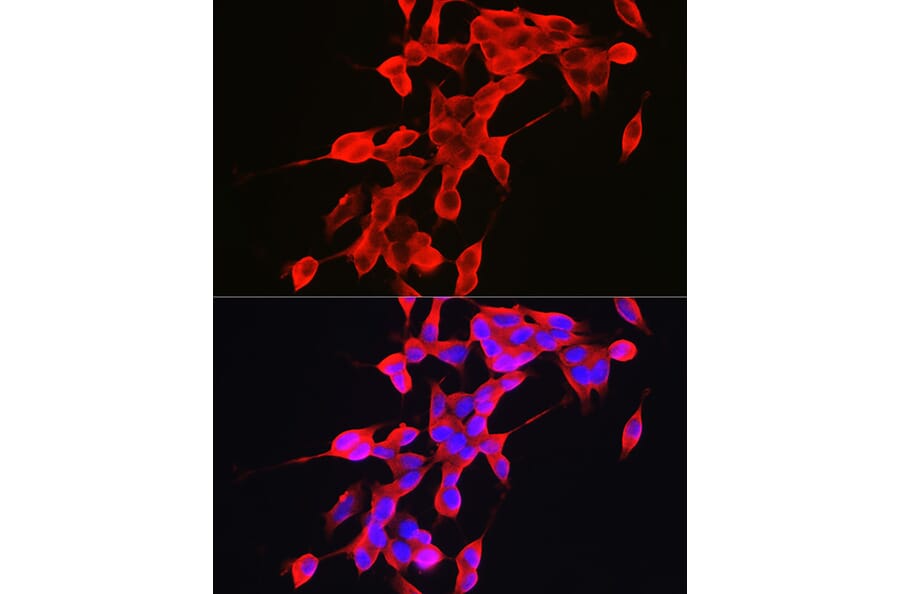 Immunofluorescence - Anti-Alpha-synuclein Antibody (A15598) - Antibodies.com