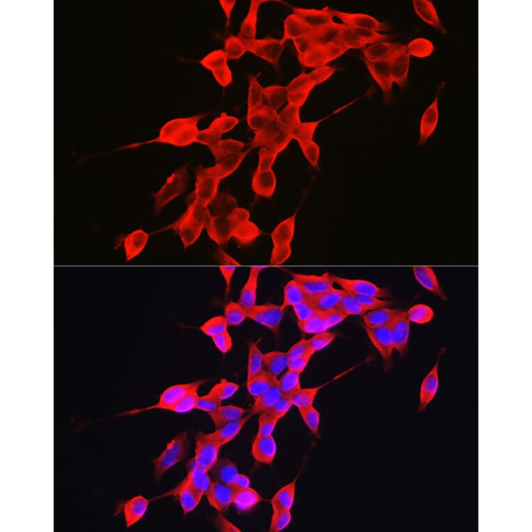 Immunofluorescence - Anti-Alpha-synuclein Antibody (A15598) - Antibodies.com