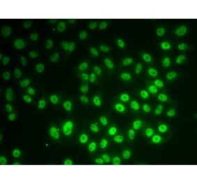 Immunofluorescence - Anti-SNRPD1 Antibody (A7216) - Antibodies.com